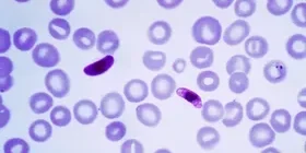 Plasmodium falciparum